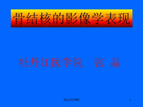骨结核的影像学表现ppt课件