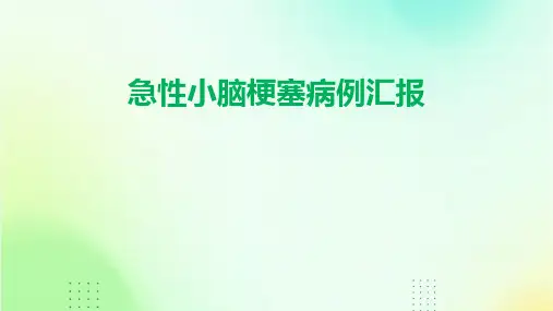 急性小脑梗塞病例汇报