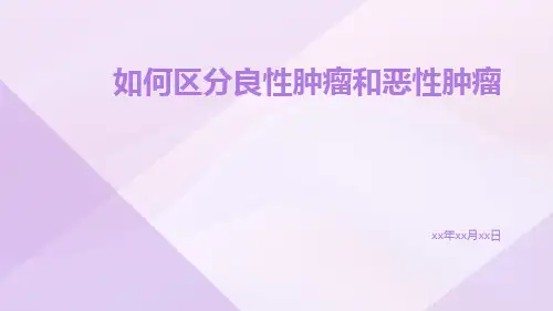如何区分良性肿瘤和恶性肿瘤