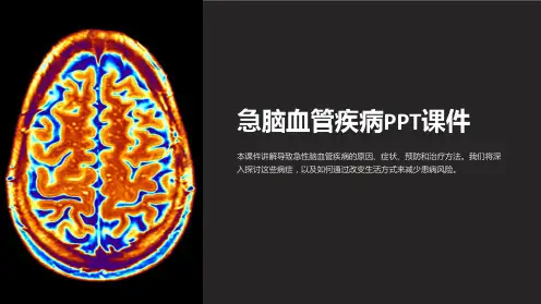 《急脑血管疾病》课件