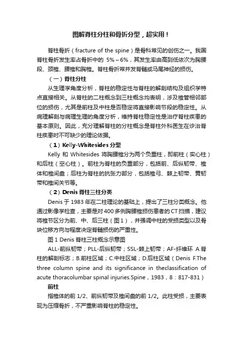 图解脊柱分柱和骨折分型，超实用！