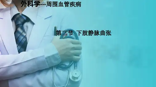 普通外科—周围血管疾病—下肢静脉曲张