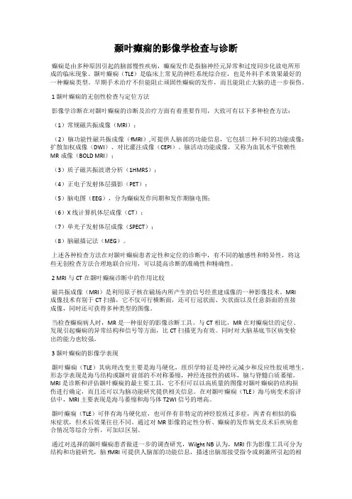 颞叶癫痫的影像学检查与诊断