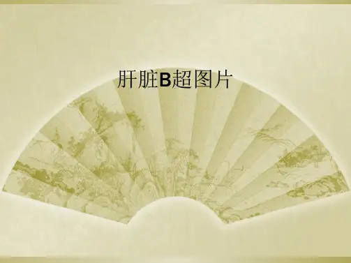 肝脏B超图片