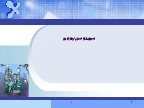 腹腔镜右半结肠切除术ppt课件