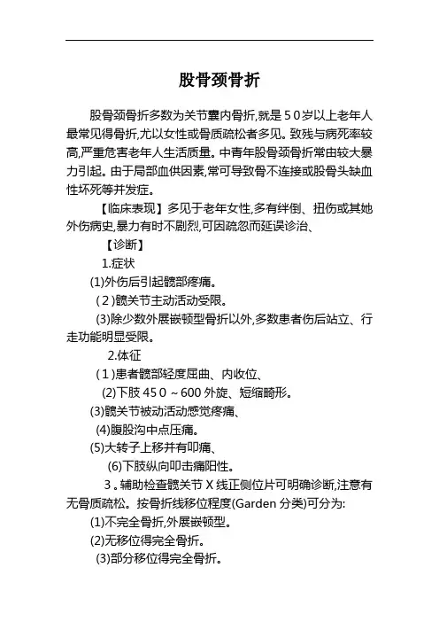 股骨骨折诊疗指南