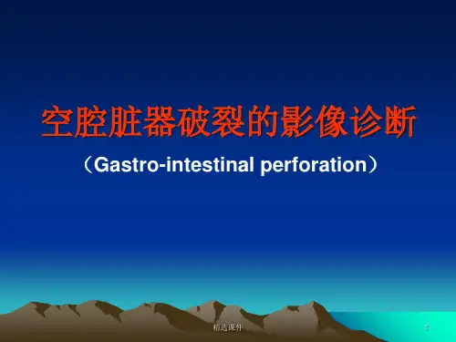 空腔脏器穿孔的影像诊断