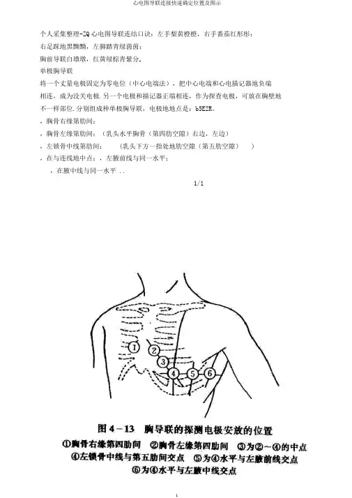 心电图导联连接快速确定位置及图示