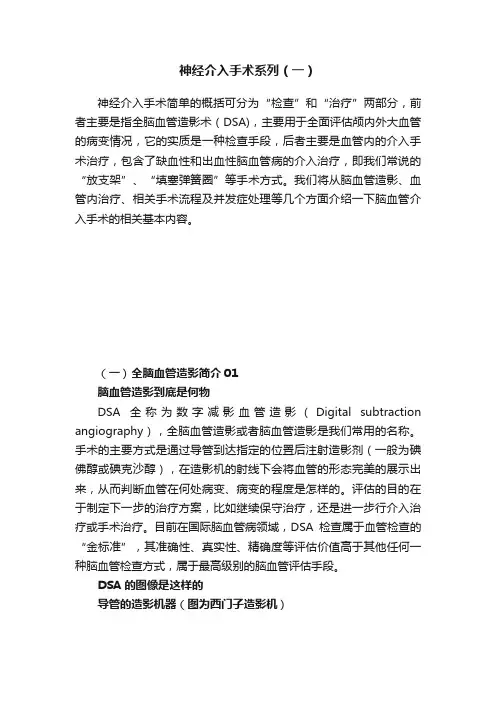 神经介入手术系列（一）