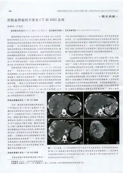 肝脏血管瘤的不常见CT和MRI表现