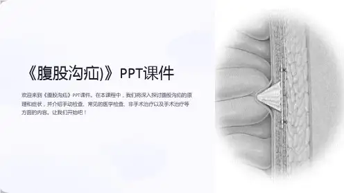 《腹股沟疝)》课件