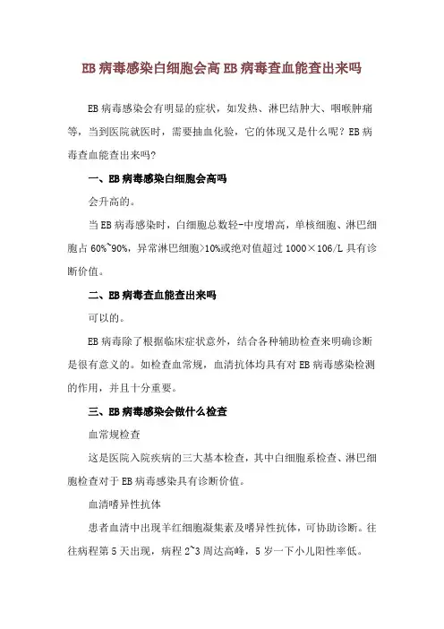 EB病毒感染白细胞会高 EB病毒查血能查出来吗