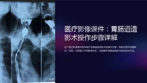《医疗影像课件：胃肠道造影术操作步骤详解》