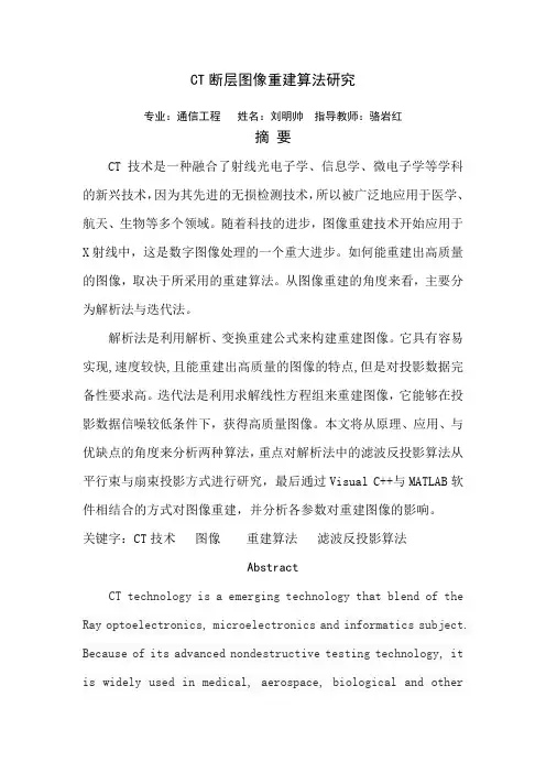 CT断层图像重建算法研究.