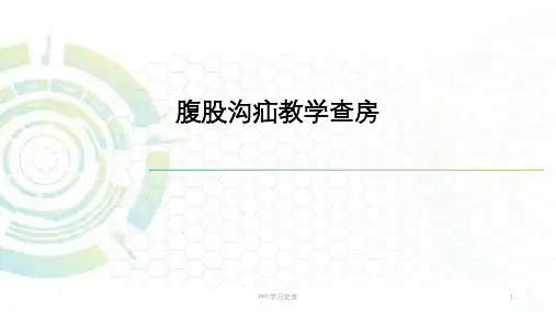 腹股沟疝教学查房ppt课件