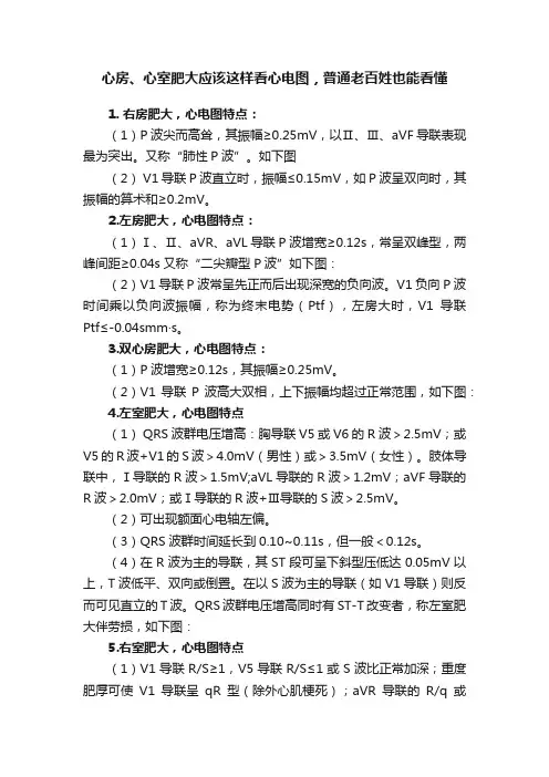 心房、心室肥大应该这样看心电图，普通老百姓也能看懂