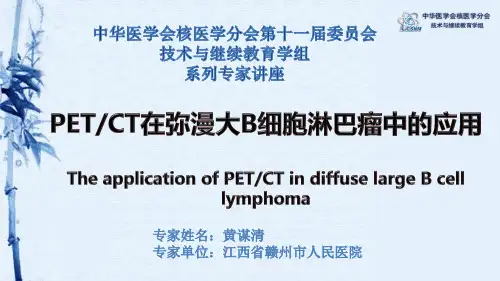 弥漫大B细胞淋巴瘤概述-核医学专业网