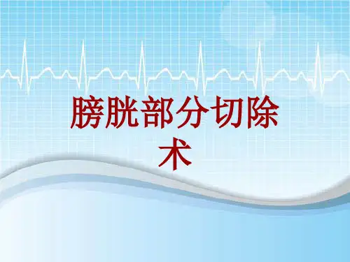 手术讲解模板：膀胱部分切除术