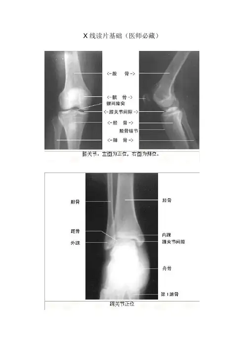 临床医师X线读片基础