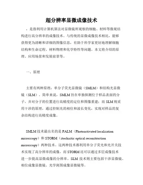 超分辨率显微成像技术