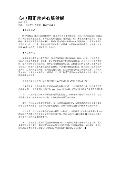 心电图正常≠心脏健康