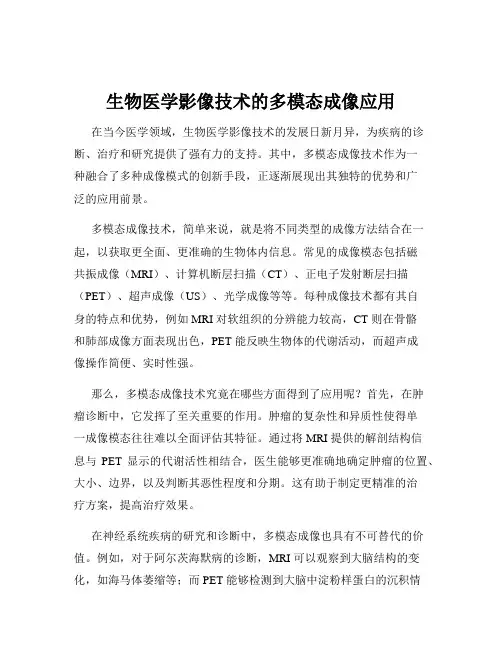 生物医学影像技术的多模态成像应用