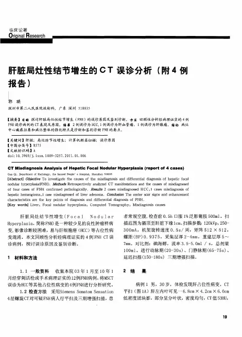 肝脏局灶性结节增生的CT误诊分析(附4例报告)