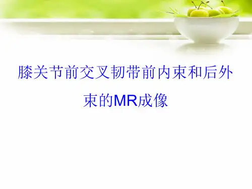 膝关节前交叉韧带前内束和后外束的 MR成像