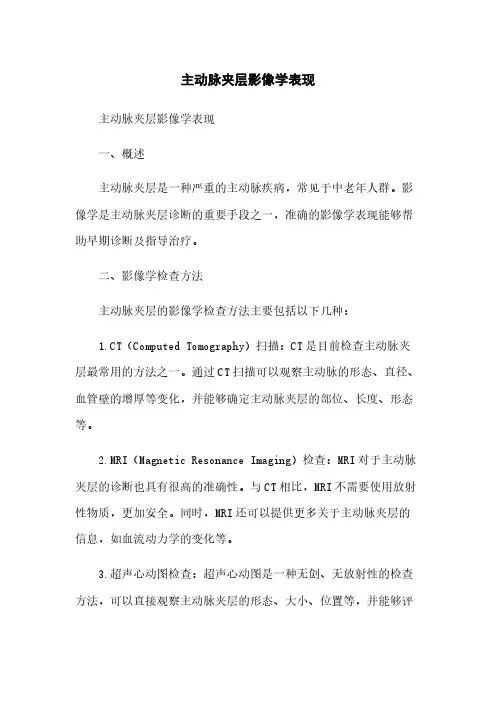 主动脉夹层影像学表现