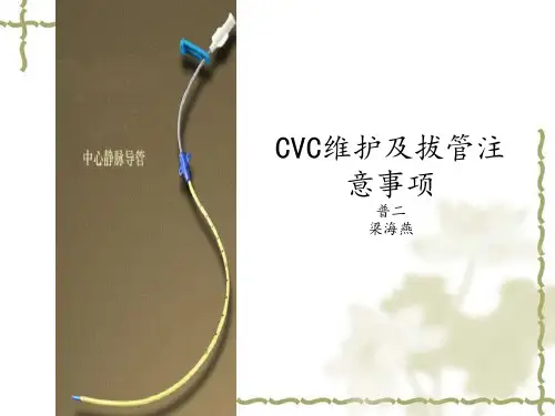 中心静脉导管(CVC)的置管与维护