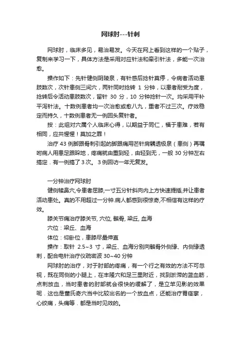 网球肘---针刺