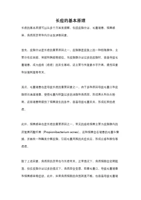 长痘的基本原理