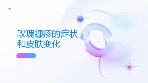玫瑰糠疹症状和皮肤变化的了解