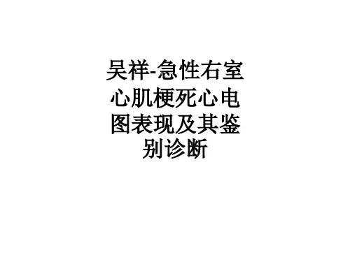 [医学]吴祥-急性右室心肌梗死心电图表现及其鉴别诊断