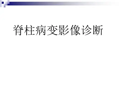 脊柱病变影像表现PPT