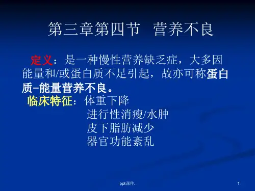 儿童佝偻病ppt课件