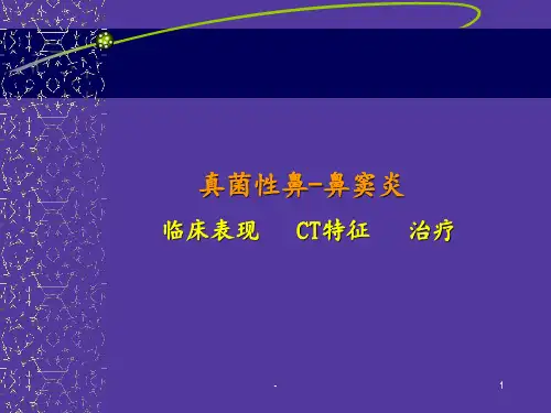 真菌性鼻鼻窦炎 ppt课件