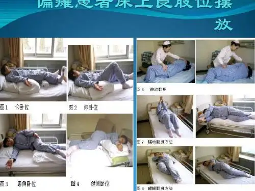 偏瘫患者良肢位摆放ppt课件
