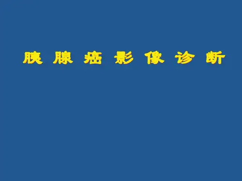 胰腺癌影像诊断PPT