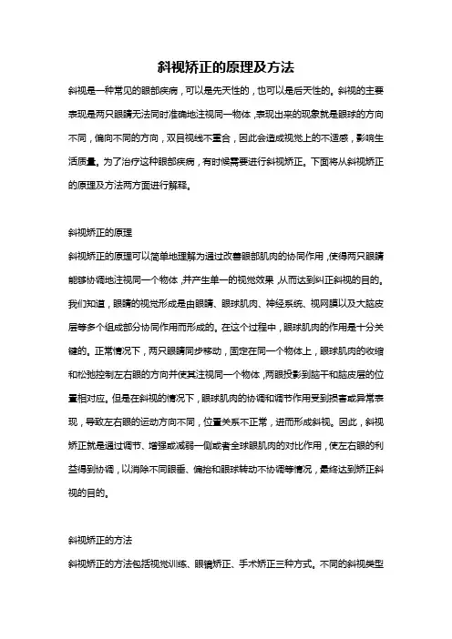 斜视矫正的原理及方法