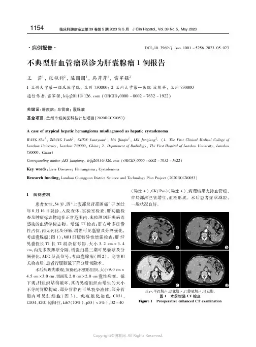 211216947_不典型肝血管瘤误诊为肝囊腺瘤１例报告