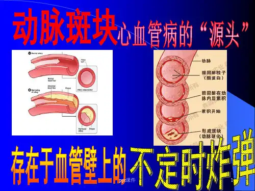 颈动脉斑块专题  ppt课件