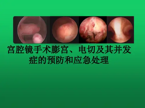 宫腔镜手术膨宫、电切及其并发症的预防和应急处理