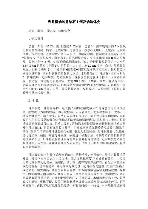 容易漏诊的胃结石1例及诊治体会
