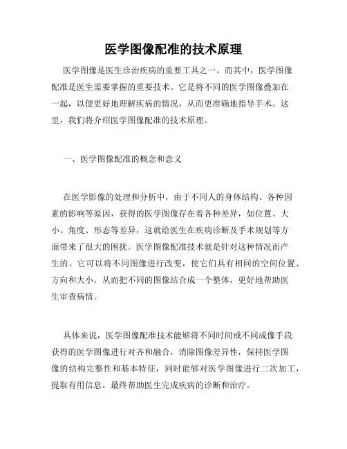 医学图像配准的技术原理