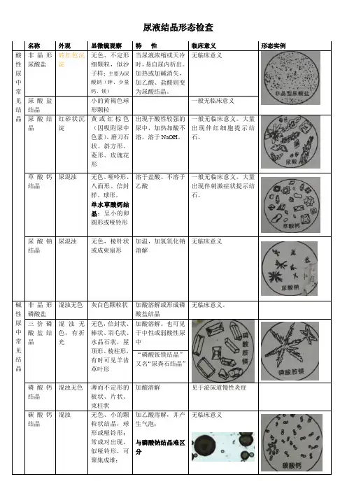 尿液结晶形态检查