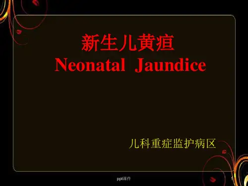 新生儿黄疸【儿科】  ppt课件