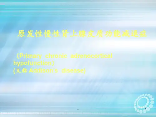 原发性肾上腺皮质功能减退症ppt课件