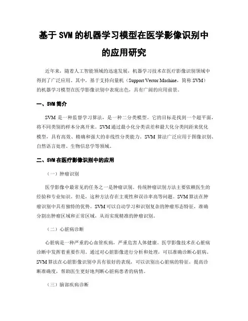 基于SVM的机器学习模型在医学影像识别中的应用研究