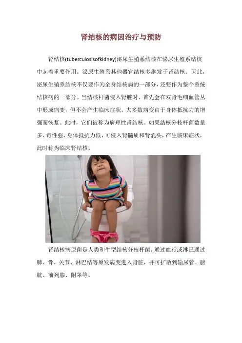 肾结核的病因治疗与预防